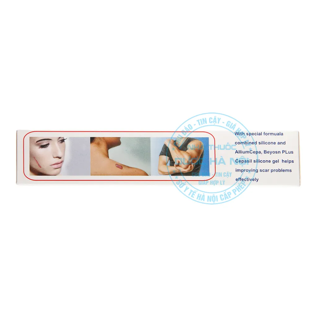 Kem bôi sẹo Cepasil Silicone Gel