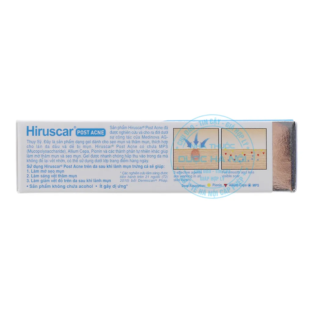 Kem Hiruscar Post Acne