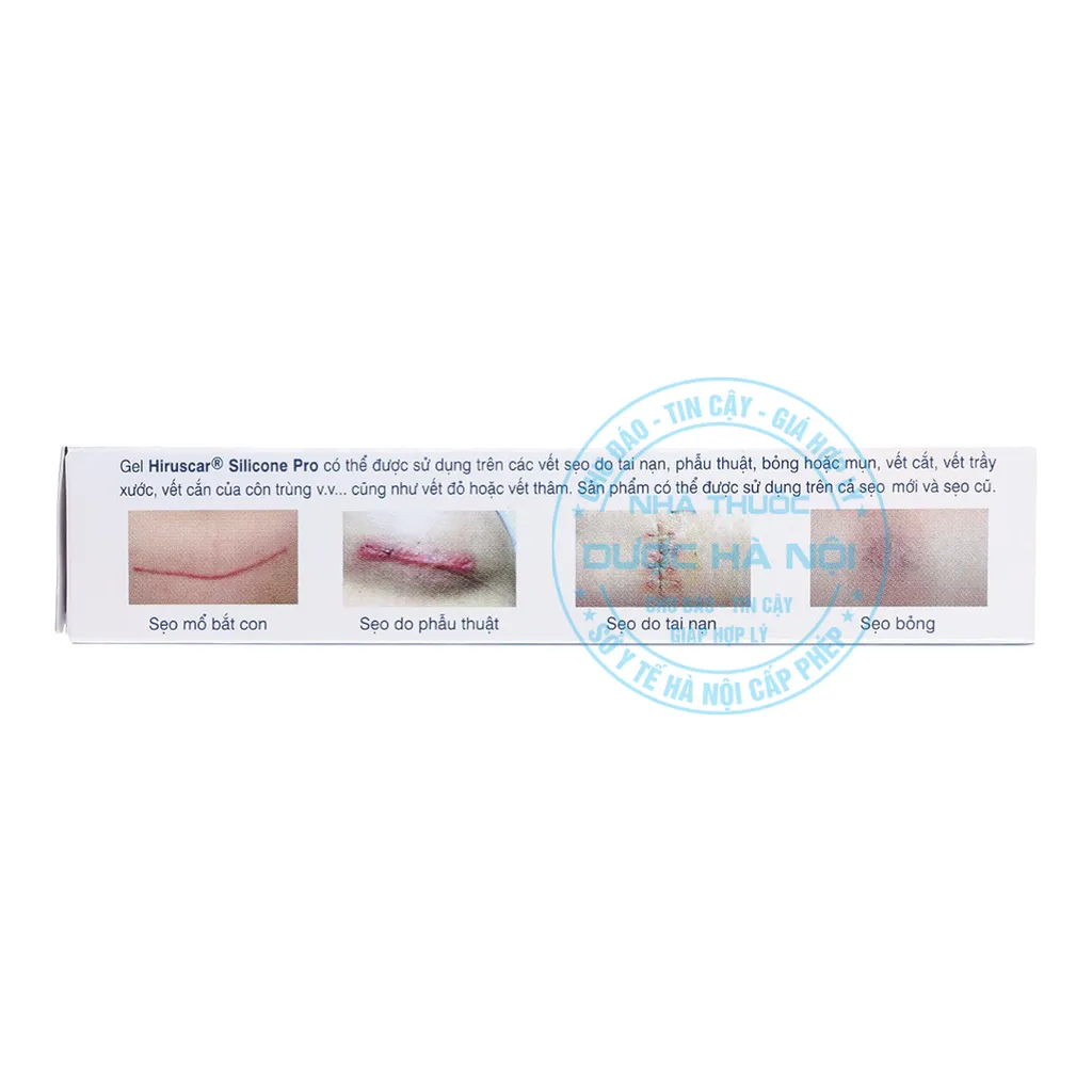 Gel mờ sẹo Hiruscar Silicon Pro